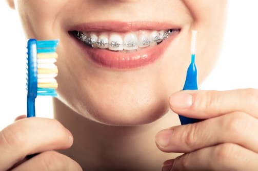 Cleaning Your Braces and Teeth Properly  Kossowan OrthodonticsKossowan  Orthodontics