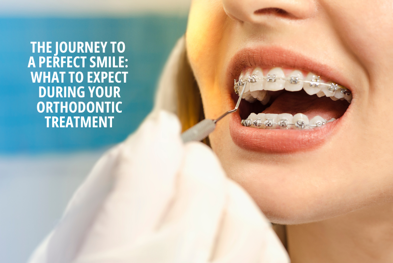 The Journey to a Perfect Smile What to Expect During Your Orthodontic Treatment