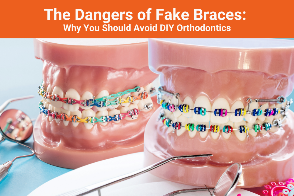 The Dangers of Fake Braces Why You Should Avoid DIY Orthodontics