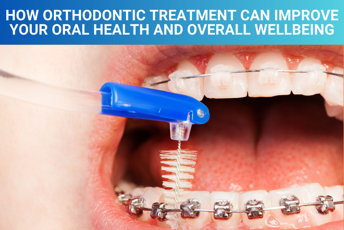 How Orthodontic Treatment Can Improve Your Oral Health and Overall Wellbeing